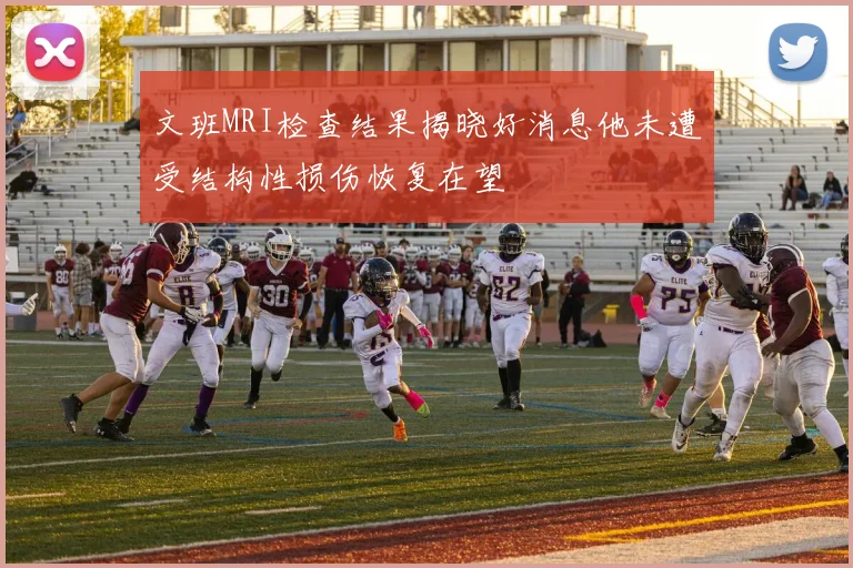 文班MRI检查结果揭晓好消息他未遭受结构性损伤恢复在望